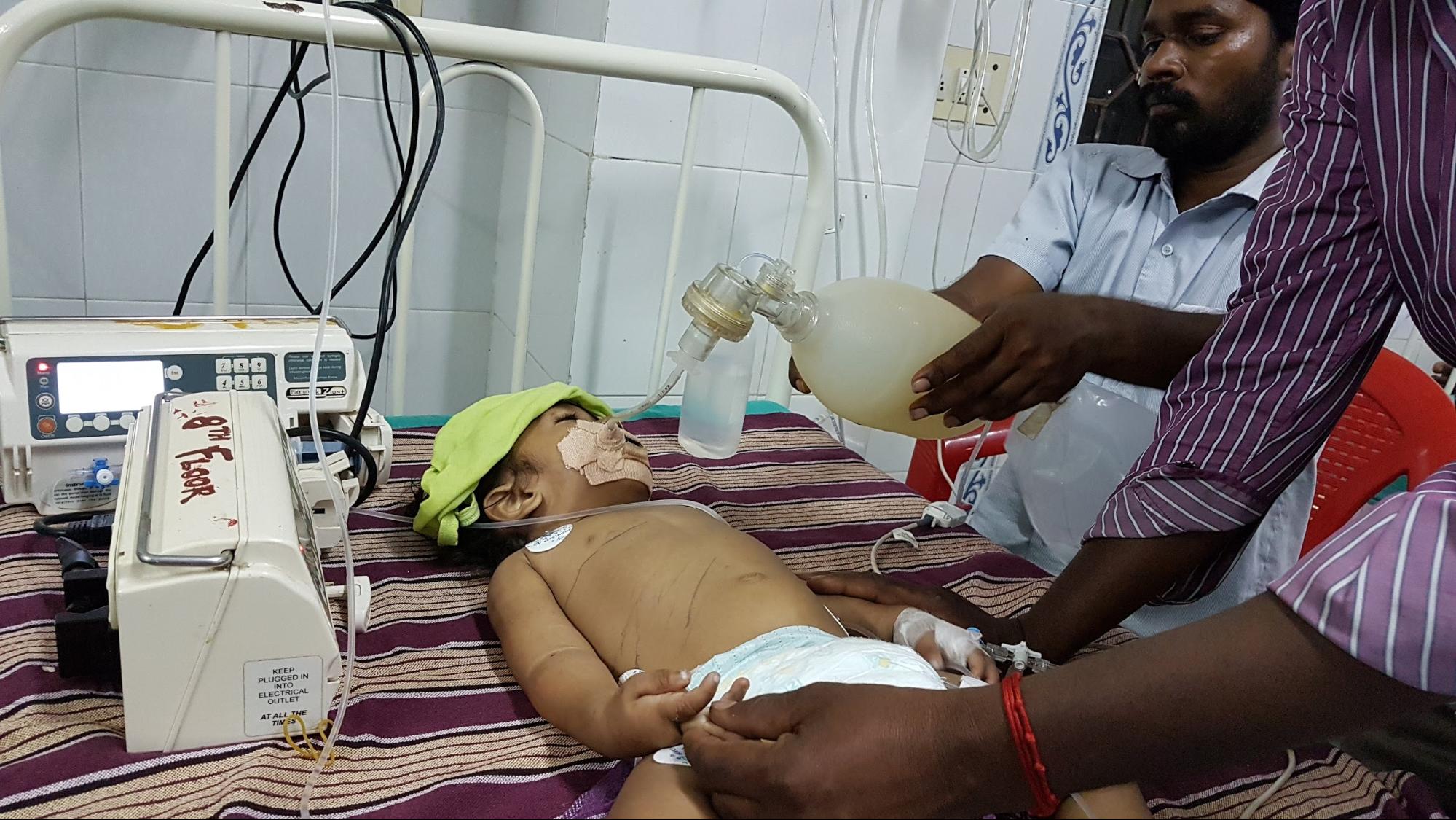 A child being manually ventilated with a resuscitator bag